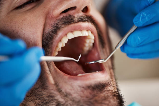 Best Emergency Dental Care for Sports Injuries in Cabot, AR